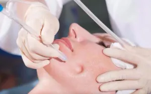 JetPeel Luxury Vitamin Infusion Facial Course of 4 1 FREE (Save €150)