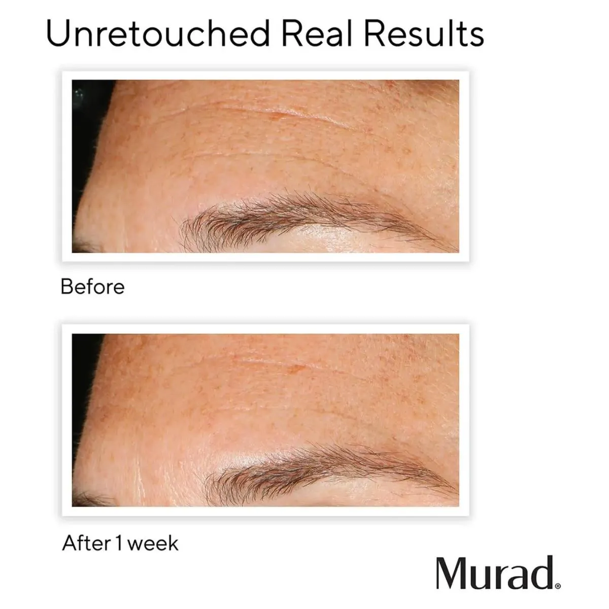 Murad | Replenishing Multi-Acid Peel 100ml